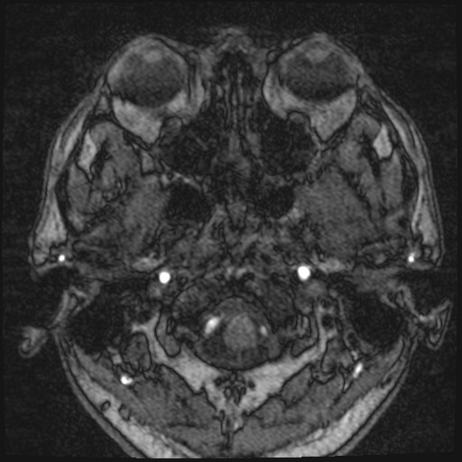 Click on the Serie image to view the images of VILLANUEVA, WILLIAM A.